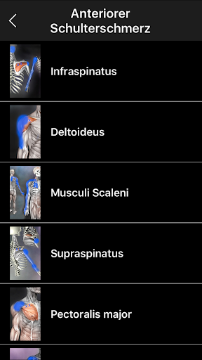 Muskel Triggerpunkte Anatomie Bildschirmfoto 5