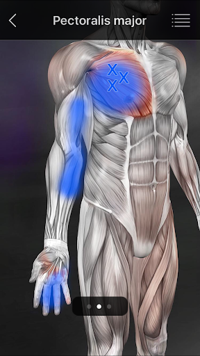 Muskel Triggerpunkte Anatomie Bildschirmfoto 12