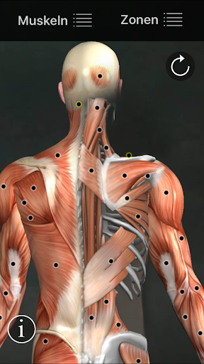 Muskel Triggerpunkte Anatomie Bildschirmfoto 14